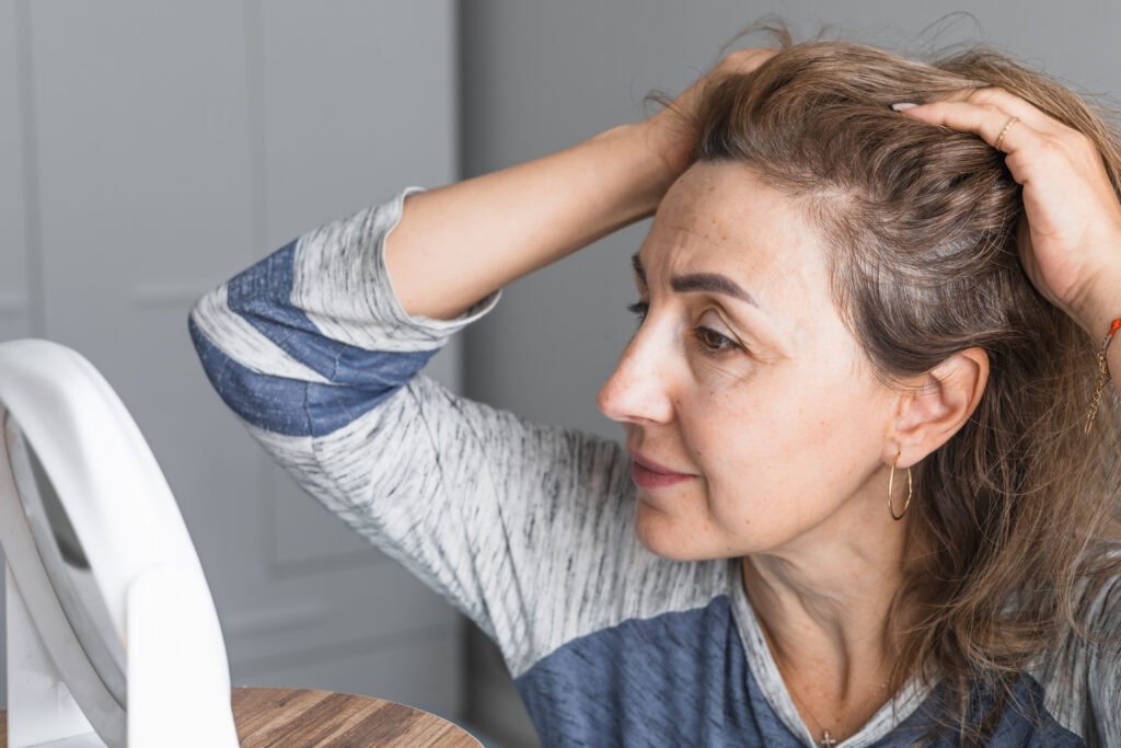 Γυναικεία αραίωση μαλλιών